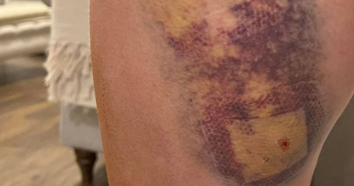 Daughter screamed during ‘barbaric’ dog attack