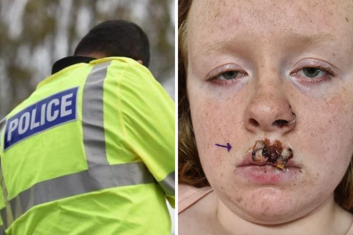 Man and woman charged after dog attack left teenage girl with serious injuries