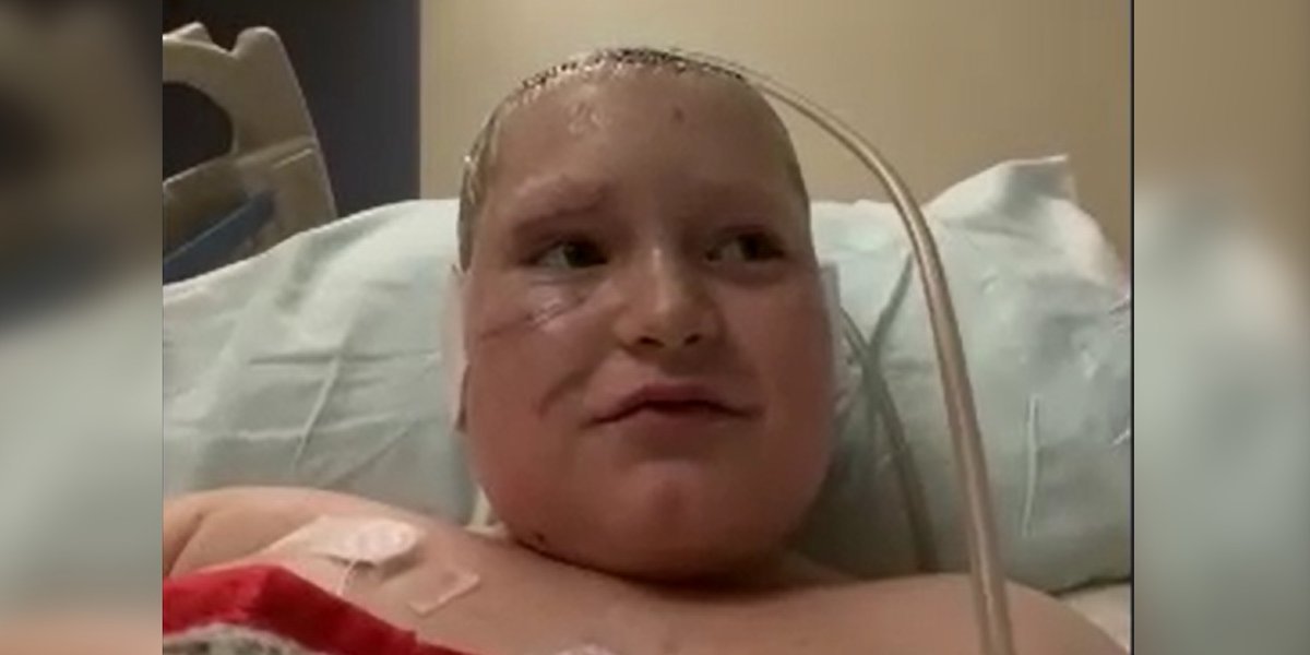 11-year-old dog attack survivor shares his long road to recovery