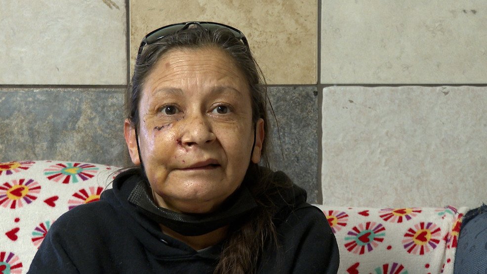 Dog attack victims speaks out; Animal Protective Services provides tips